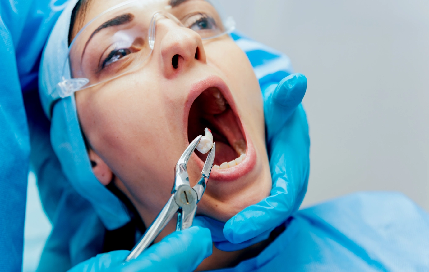 Tooth extraction aftercare guide